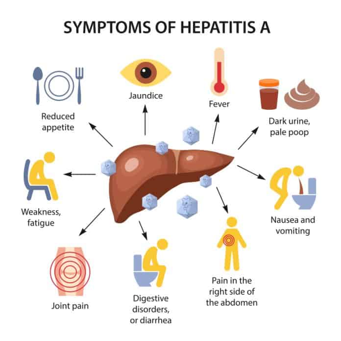 hepatita a